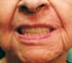 Slider image (10) Smiletec® - Leading Mexicali Dental Clinic